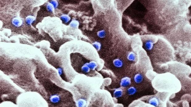 Cura do HIV segue distante, mas descoberta científica renova esperança