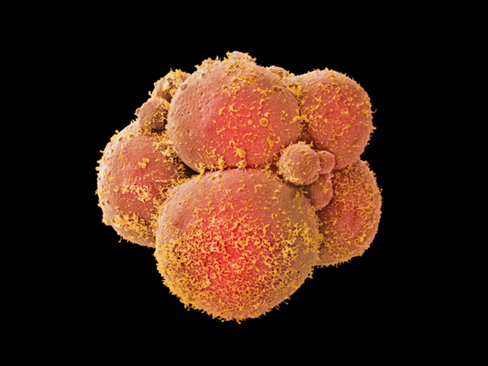 Gravidez: os avanços nas técnicas para preservar a fertilidade do embrião