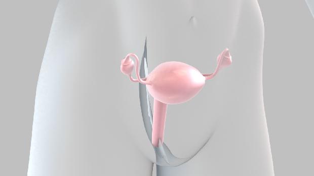 ovario-cancer-gene-20110808-original.jpeg