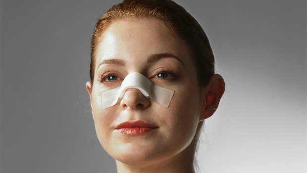 rinoplastia