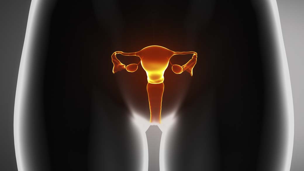 Por que uma doença que afeta mais de 170 milhões de mulheres vai mudar de nome
