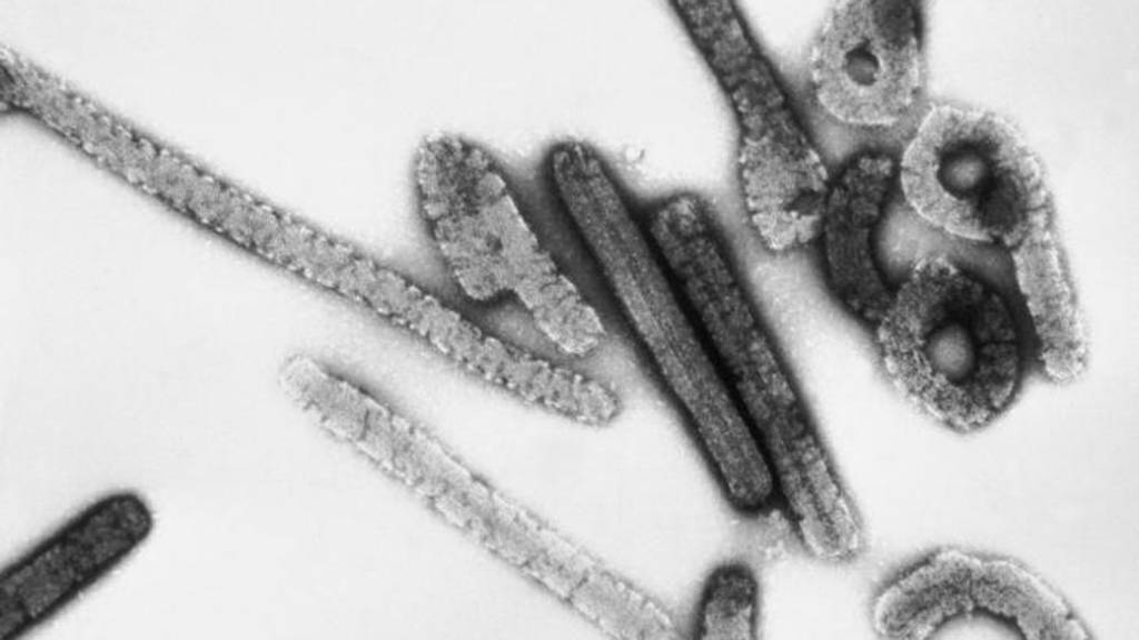 Etiópia registra primeiro surto de doença ‘prima’ do Ebola