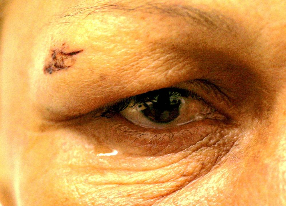 Ana Araujo retrata “Marias Marcadas pela Violência”. Natural de Tacaratu, no sertão pernambucano, Ana fotografou vítimas de violência doméstica no Recife, onde reside atualmente