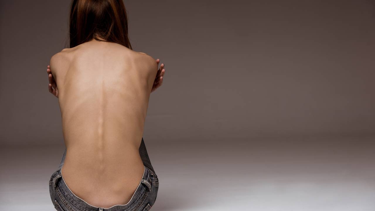 Anorexia