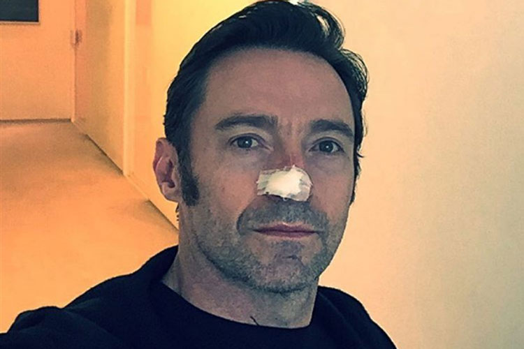Hugh Jackman tem novo câncer de pele diagnosticado