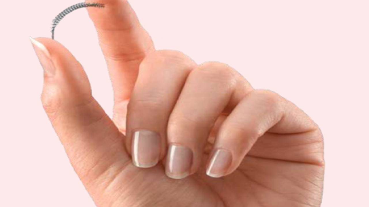 Anticoncepcional permanente Essure da Bayer