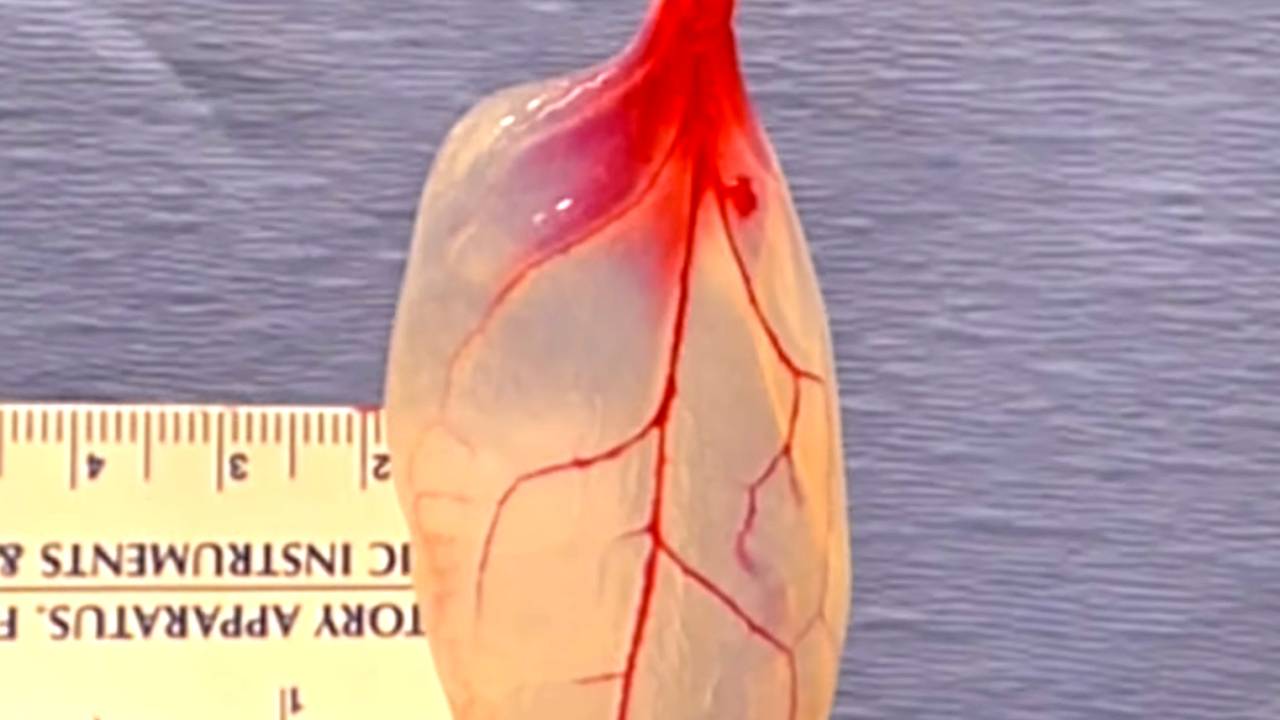 Folhas de espinafre podem ser utilizadas como veias