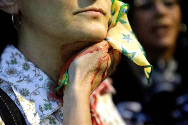 Manifestante ferida por bala de borracha durante protestos no Rio de Janeiro contra as reformas da previdência e trabalhista do governo Michel Temer - 28/04/2017 Manifestante ferida por bala de borracha durante protestos no Rio de Janeiro contra as reformas da previdência e trabalhista do governo Michel Temer - 28/04/2017