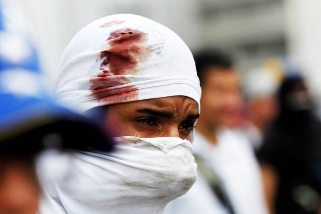 Manifestante ferido durante protesto contra o governo de Nicolás Maduro em Caracas, Venezuela - 06/04/2017 Manifestante ferido durante protesto contra o governo de Nicolás Maduro em Caracas, Venezuela - 06/04/2017