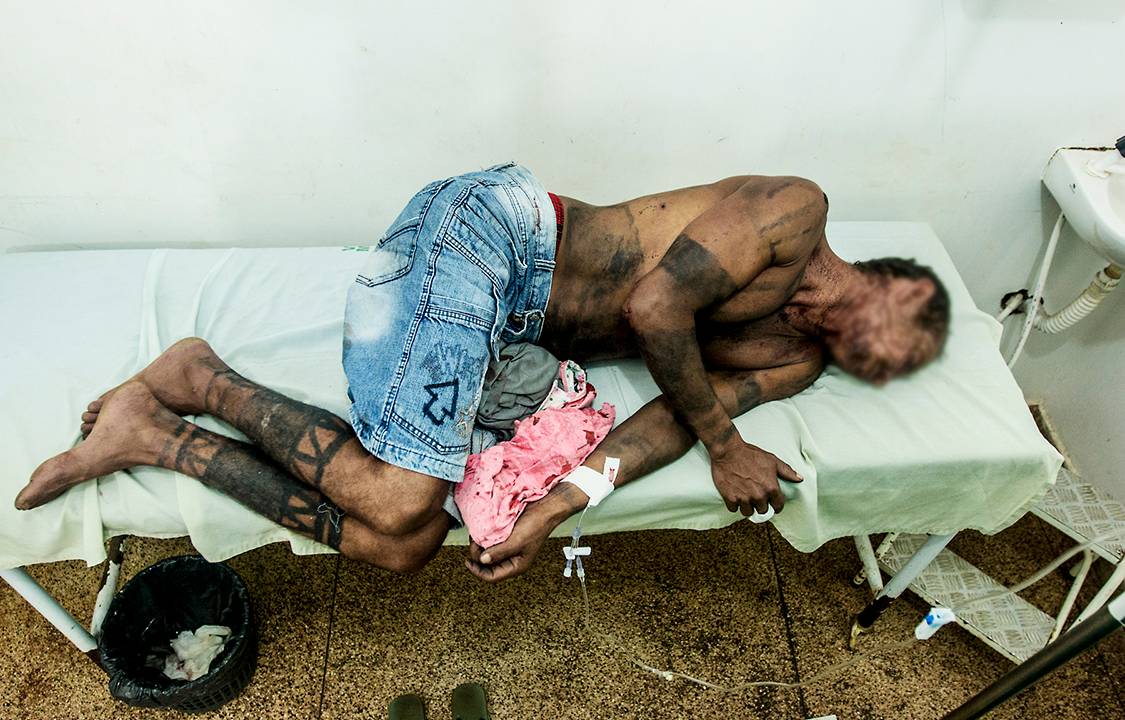Indios da etnia Gamela (Viana, no Maranhão) sofrem ataque na nova retomada de terra que estavam fazendo no municício de Viana. Cerca de 200 homens amarmados com armas de fogo homens com facões e paus. Há cerca de 10 feridos, os casos mais graves que estão sendo transferidos para a capital do estado São Luís. Os indígenas afirmam que o ataque já estava sendo organizado independente de acontecer ou não a retomada, pois havia um grupo que se auto intitulara "movimento pela paz" que estava incitando moradores do povoado Santeiro. A rádio local estava abrindo espaço para políticos contrários a retomadas, darem entrevistas - criando um ambiente de animosidade nos últimos dias.