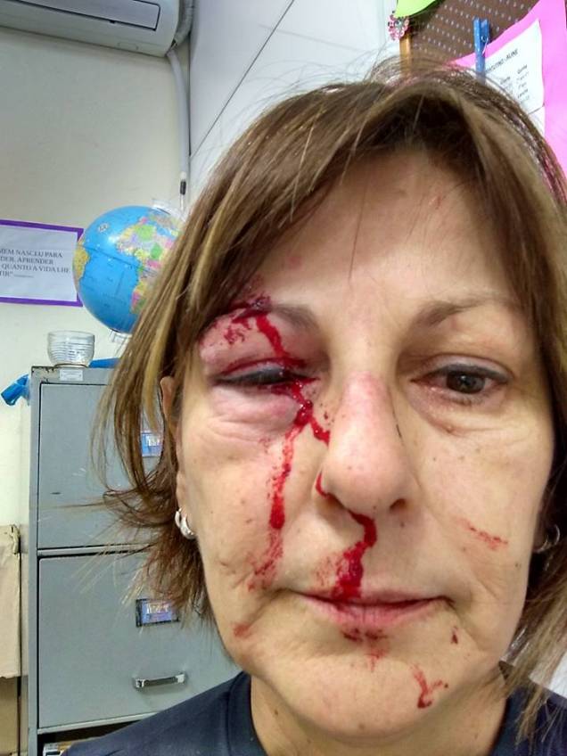 Márcia Friggi, professora da refe pública de ensino que foi agredida dentro da escola em Santa Catarina Márcia Friggi, professora da refe pública de ensino que foi agredida dentro da escola em Santa Catarina