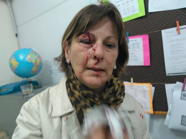 Márcia Friggi, professora da refe pública de ensino que foi agredida dentro da escola em Santa Catarina Márcia Friggi, professora da refe pública de ensino que foi agredida dentro da escola em Santa Catarina