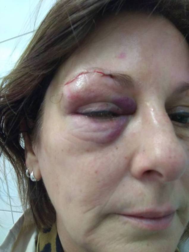 Márcia Friggi, professora da refe pública de ensino que foi agredida dentro da escola em Santa Catarina Márcia Friggi, professora da refe pública de ensino que foi agredida dentro da escola em Santa Catarina