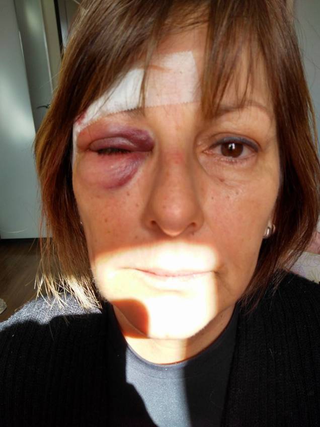 Márcia Friggi, professora da refe pública de ensino que foi agredida dentro da escola em Santa Catarina Márcia Friggi, professora da refe pública de ensino que foi agredida dentro da escola em Santa Catarina