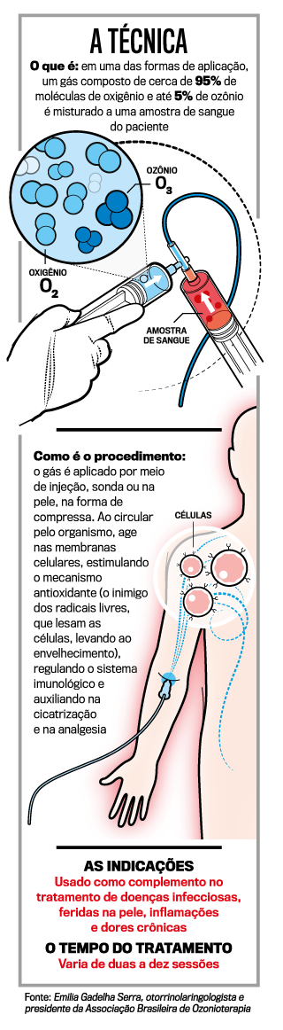 arte-ozônio