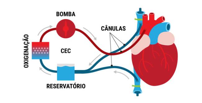 arte-transplante-coracao-2