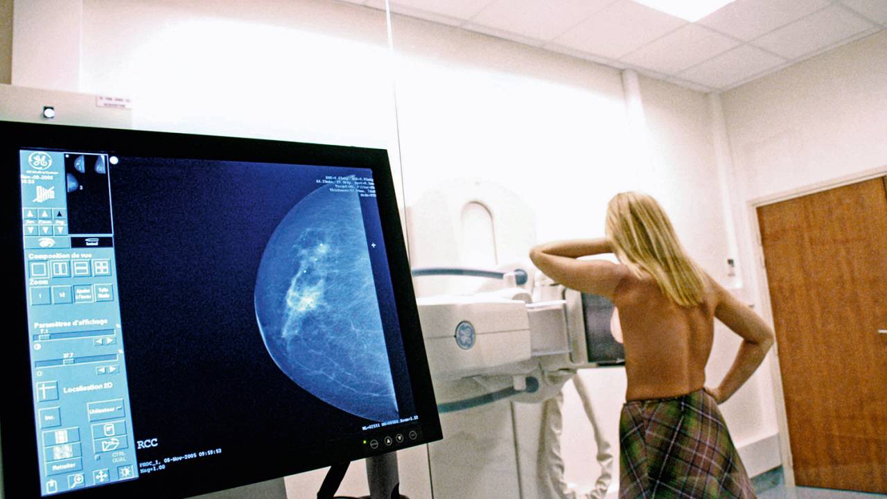 A ciência avança - O grupo que só tomou o medicamento teve índice de cura igual ao do que fez a químio