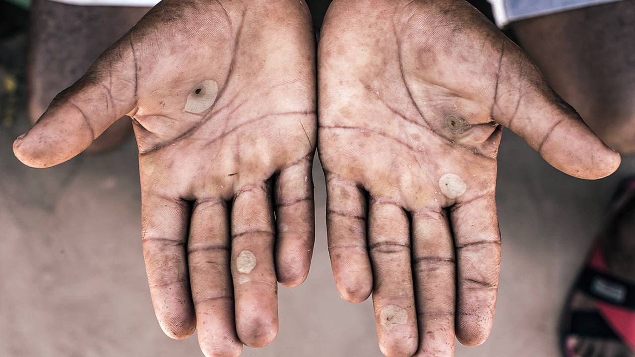 .