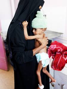 Crise humanitária no Iêmen Crise humanitária no Iêmen