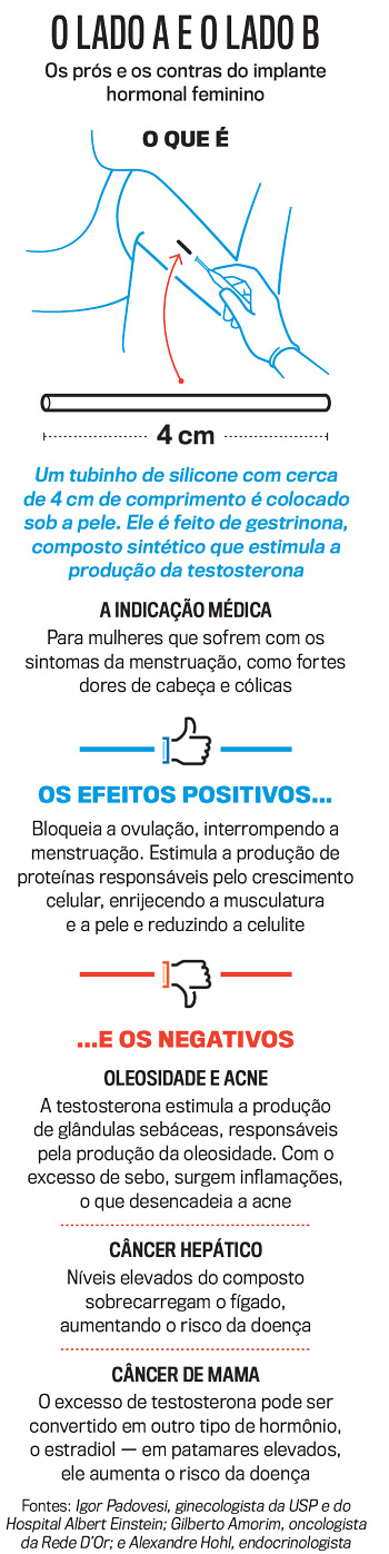 arte-implante-hormonal