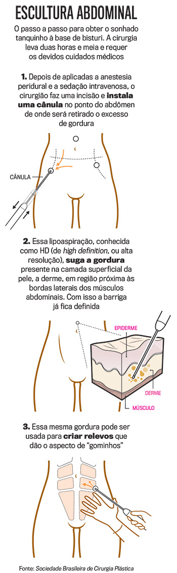 arte-lipo arte-lipo