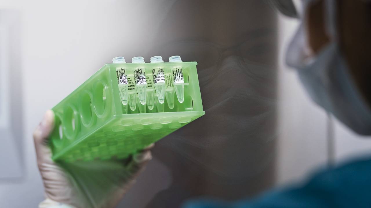 CORRIDA - Fiocruz: dedicação total à produção de kits para testes