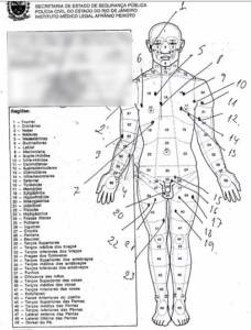 Laudo mostra que seis das 30 perfurações no corpo de Anderson do Carmo foram na região da genitália Laudo mostra que seis das 30 perfurações no corpo de Anderson do Carmo foram na região da genitália
