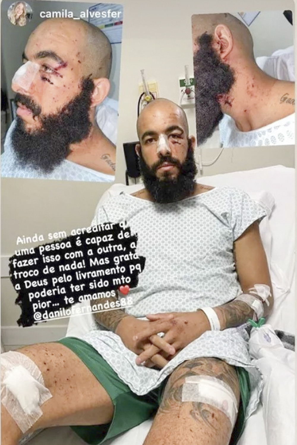 DANILO-FERNANDES-INSTAGRAM-VIOLENCIA-BAHIA-COPA-DO-NORDESTE-2022-01.jpg ATENTADO - Danilo Fernandes: o goleiro do Bahia foi atingido por bomba lançada por seus próprios torcedores -