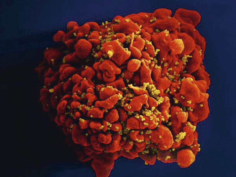 BOX-CELULA-INFECTADA-17-7-25-173730hiv-virus.jpg ATAQUE - Célula infectada por HIV: danos ao material genético -