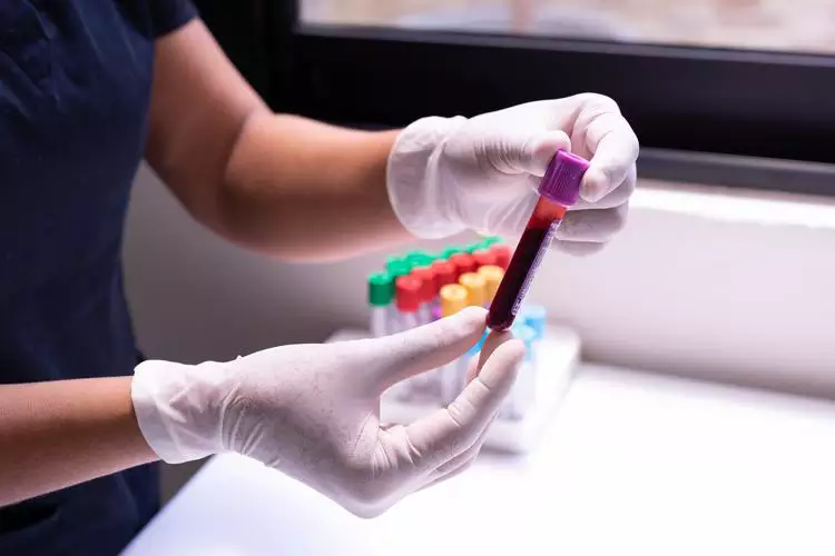 Já fez seu check-up do coração? Saiba o que ele deve contemplar