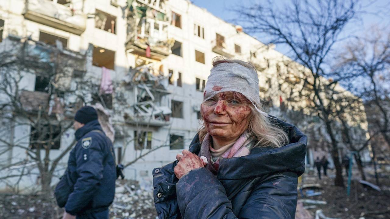 DESTRUIÇÃO - Bombardeio russo: drama humanitário na guerra sem fim -