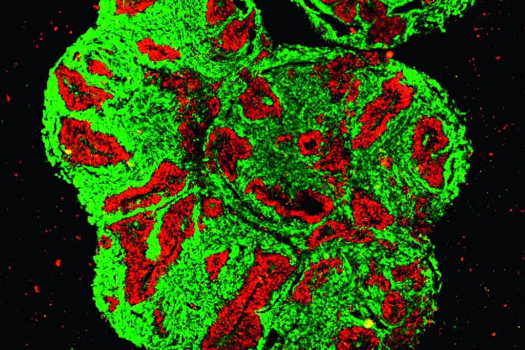 Organoid.png ORIGEM - Minicérebros: úteis para conhecer a evolução da espécie -