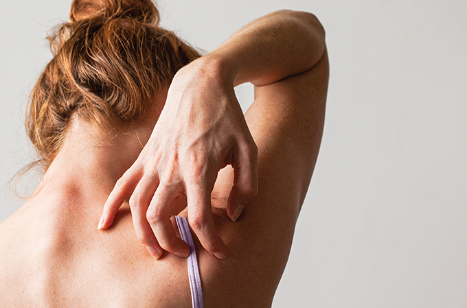 Como a coceira da dermatite atópica impacta a vida de crianças e adultos?