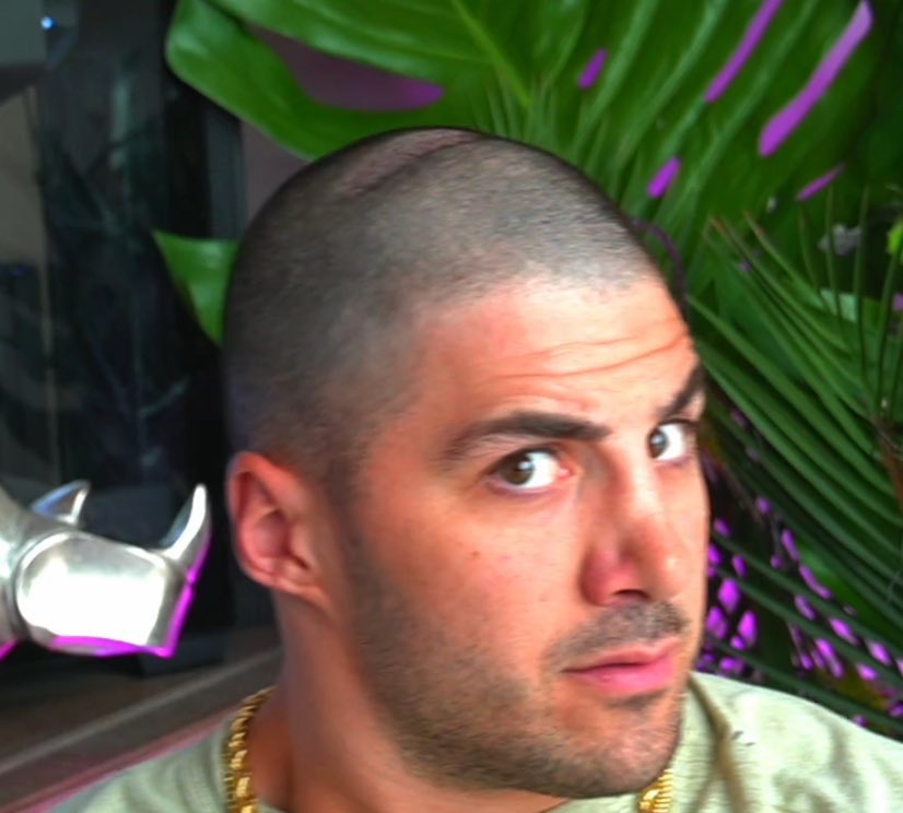 Uso prolongado de headphones pode amassar a cabeça?