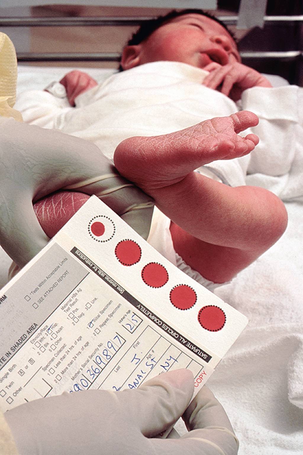 Blood test for newborn Blood test for newborn