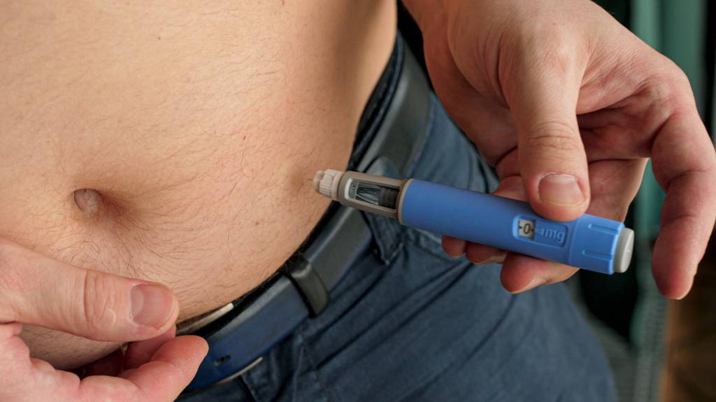 Após uso de semaglutida, quando fazer cirurgia de contorno corporal?