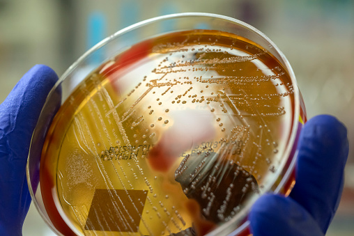 Microbiologista segurando uma placa ágar de sangue mostrando a beta-hemólise causada pela bactéria Streptococcus do Grupo A (Streptococcus pyogenes), uma das principais responsáveis pela infecção de STSS.