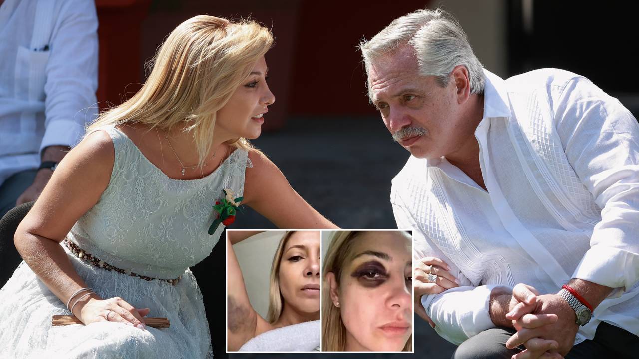 DUAS CARAS - Fernández e Fabiola em evento oficial (acima) e as fotos da agressão, em 2021: “Faz três dias que você me bate”, disse a ex-primeira-dama