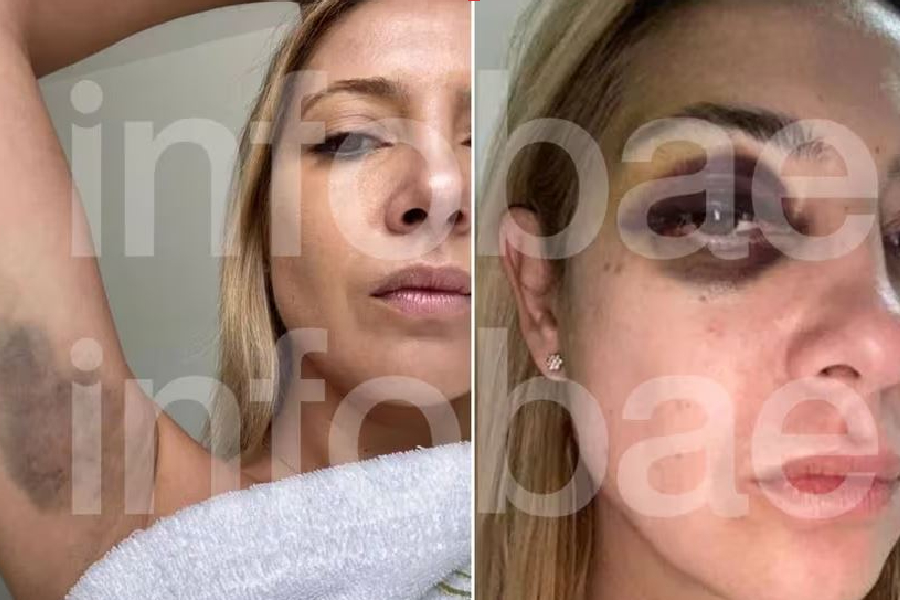 Ex-mulher de Alberto Fernández
