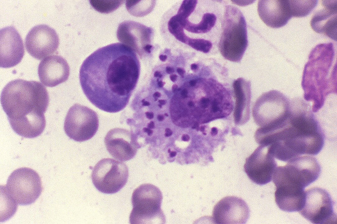 Leishmania