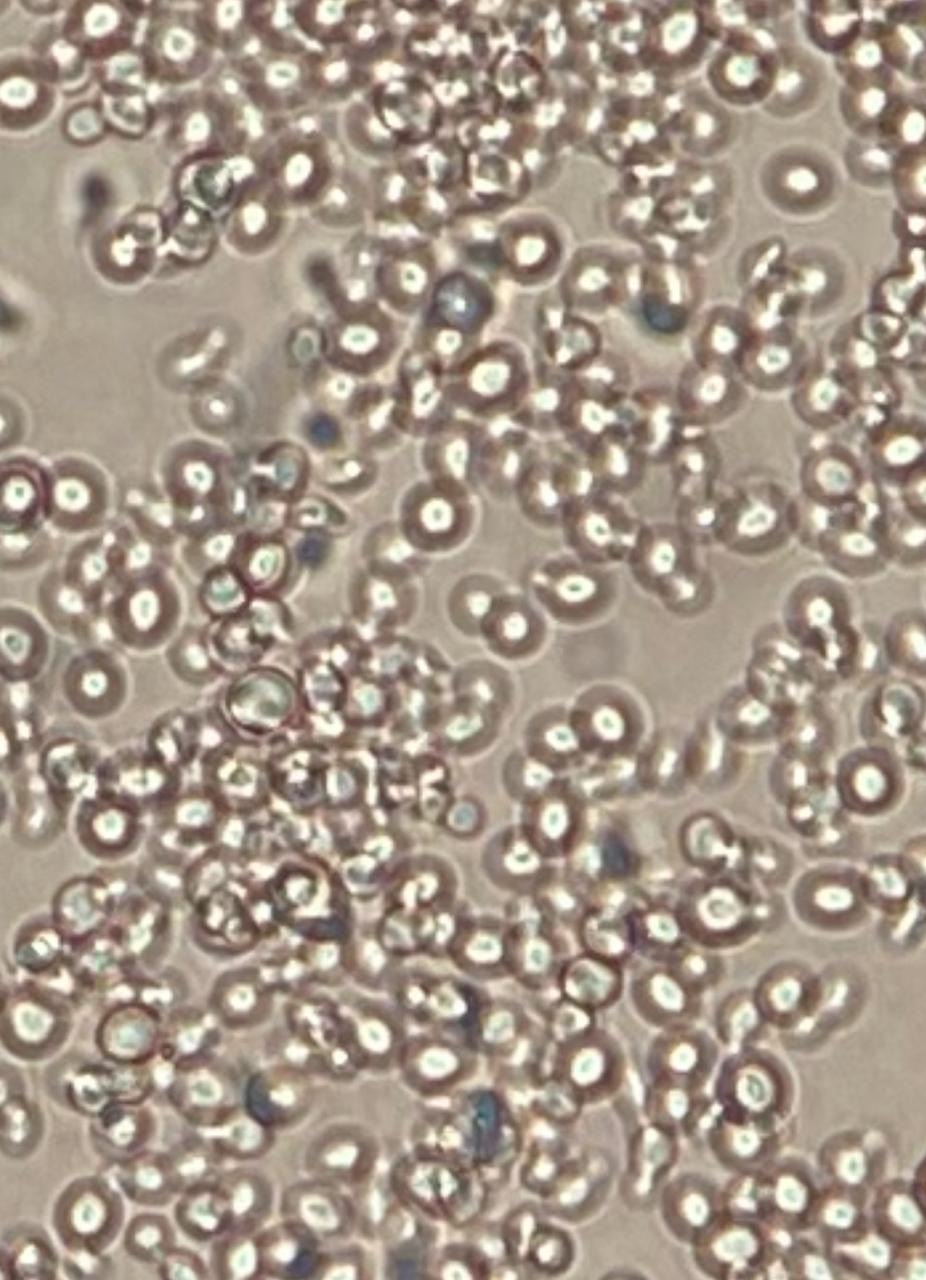 O fungo oportunista que desafia a medicina moderna