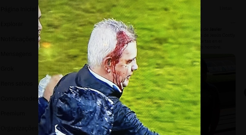 Treinador da seleção do México, Javier Aguirre, foi ferido na cabeça apos ser atingido por uma lata lançada por torcedores em jogo contra Honduras