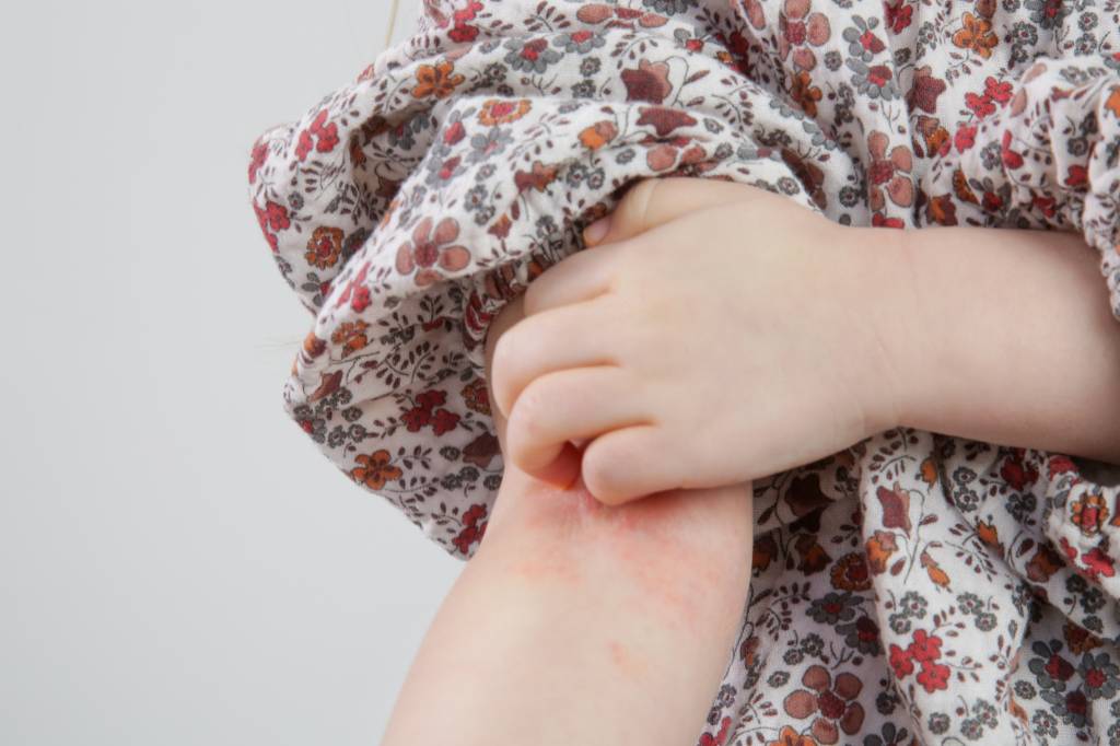 O problema de saúde infantil que tira literalmente o sono dos pais