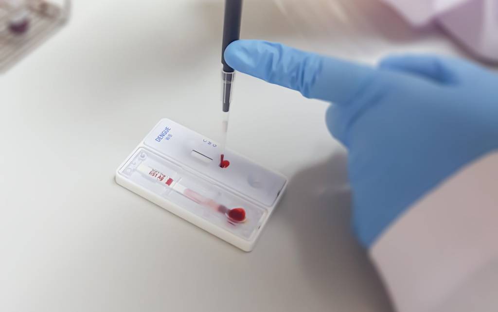 Dengue: Ministério da Saúde distribuirá 6,5 milhões de testes rápidos