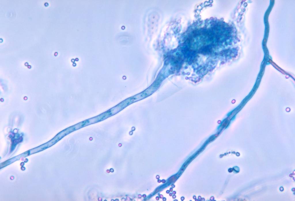 Cientistas descobrem como um fungo dribla nossa imunidade para causar doenças