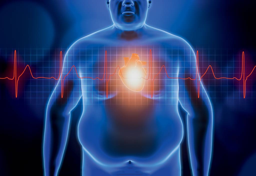 Fat or obese man chest body with heart and red ekg heartbeat curve. Blue futuristic hologram 3d rendering illustration. Obesity, healthcare, medical, wellness, heart disease concepts. EFEITO CASCATA - Risco: síndrome metabólica tem relação com doenças graves