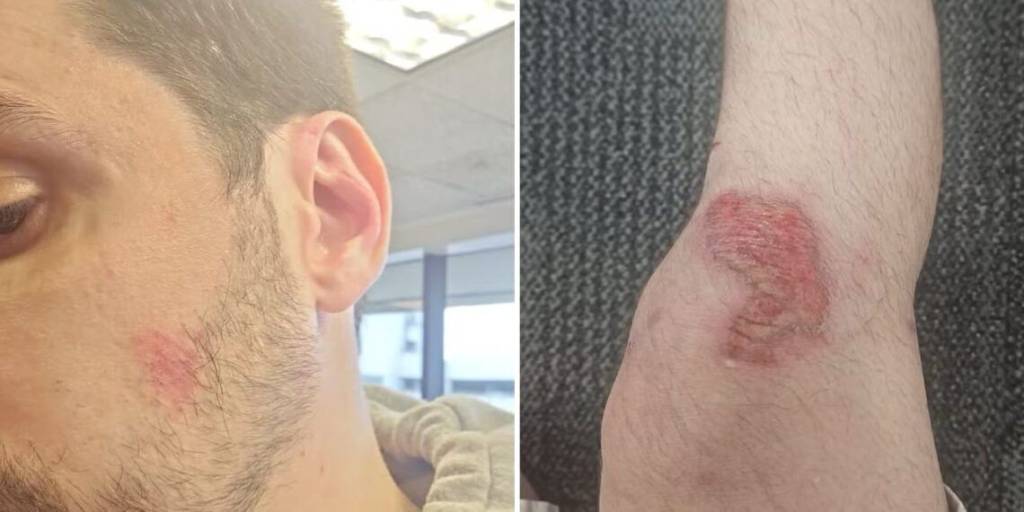 Brasileiros são presos em aeroporto de Miami após confusão com companhia aérea