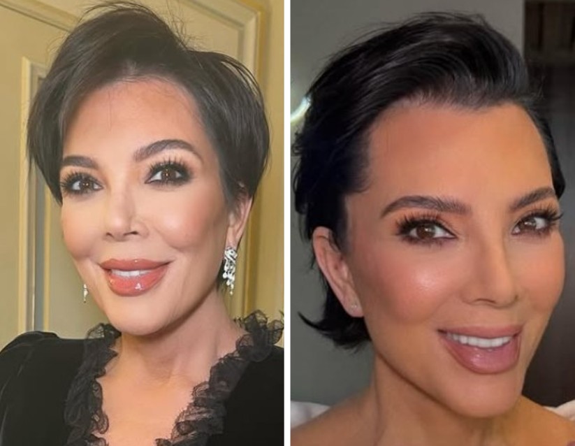 Antes e depois de Kris Jenner