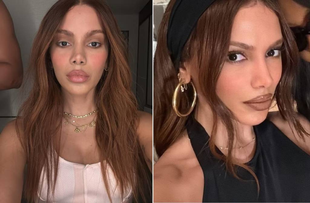 O tenso bastidor de Anitta após plástica: procedimento de Michael Jackson