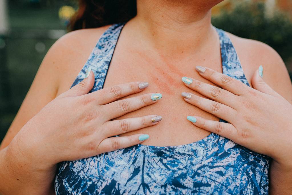 Remédio que reduz em 63% coceira por doença crônica é nova opção de tratamento no Brasil